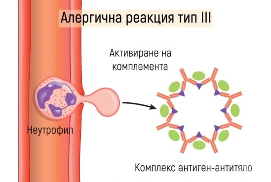 Трети тип алергична реакция