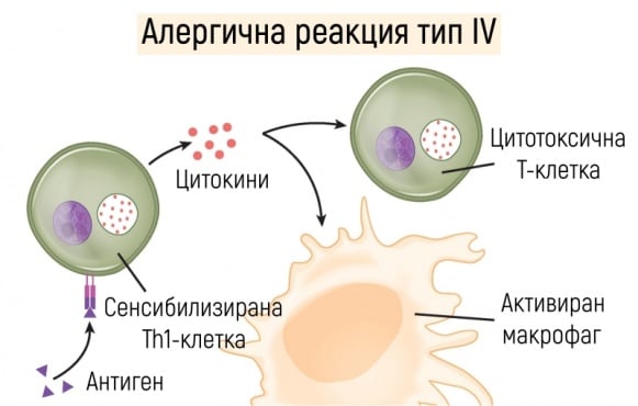 Четвърти тип алергична реакция