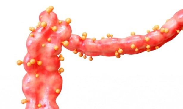 Патологични промени