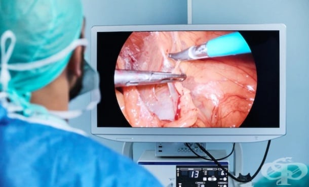 Хирургично лечение