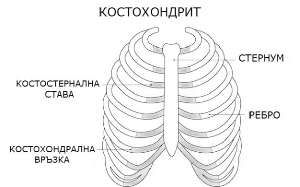 Патофизиология при костохондрит