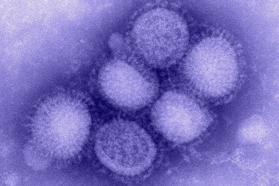 A(H1N1) - ������� �� ������� ����