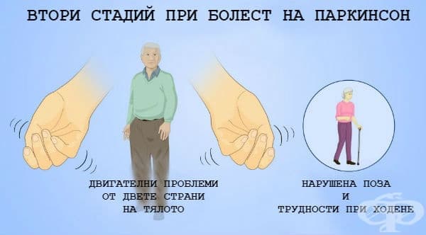 Втори стадий при болестта на Паркинсон