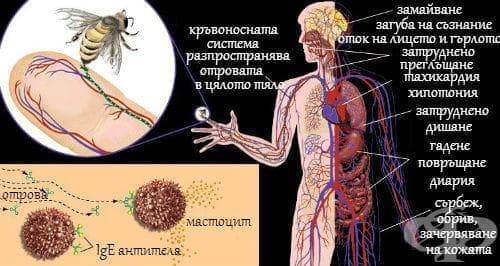 Анафилактична реакция към насекоми