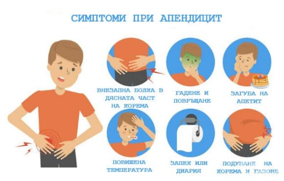 Симптоми при апендицит