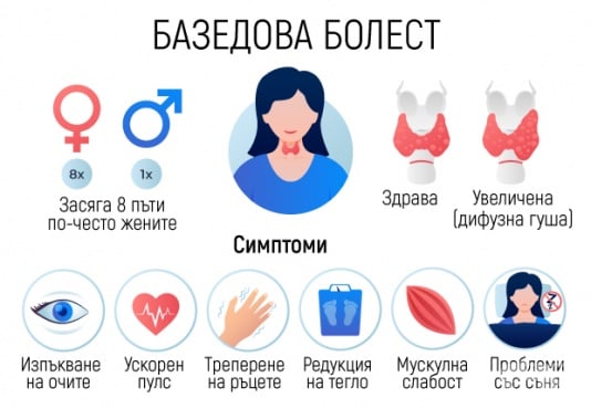 Базедова болест