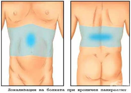 Локализация на болката при хроничен панкреатит