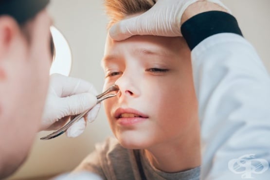 Чуждо тяло в носа