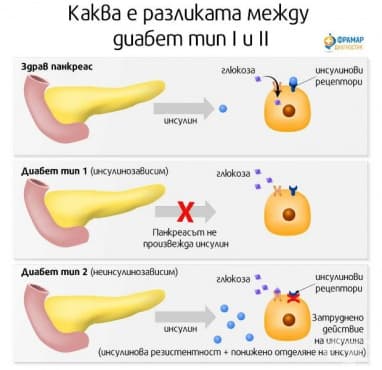 Разлика между диабет тип 1 и 2