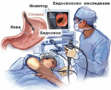 Ендоскопско изследване