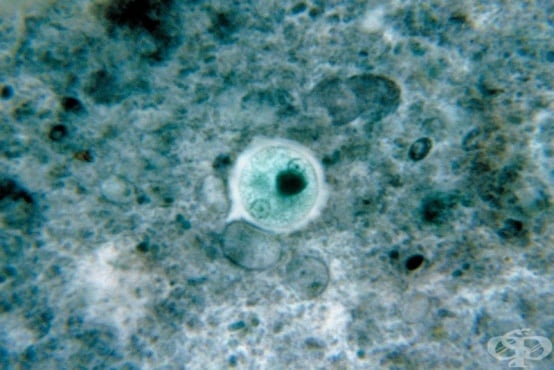 Entamoeba histolytica  