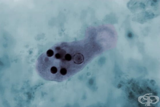 Entamoeba histolytica