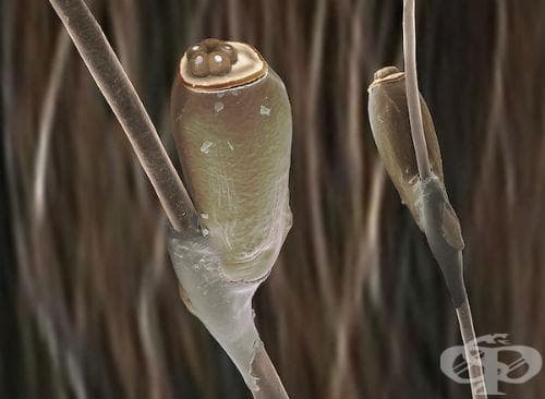 Гнида на въшка