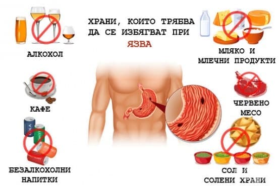 Храни, които трябва да се избягват при язва
