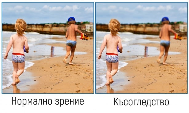 Нарушение на зрението при късогледство
