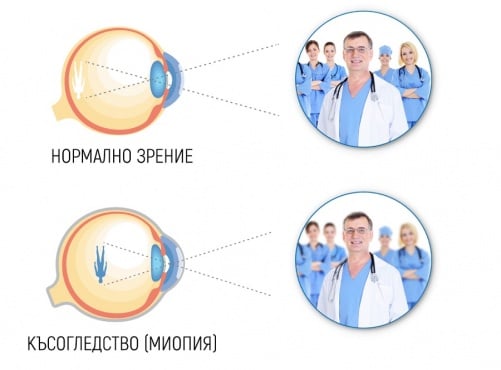 Късогледство