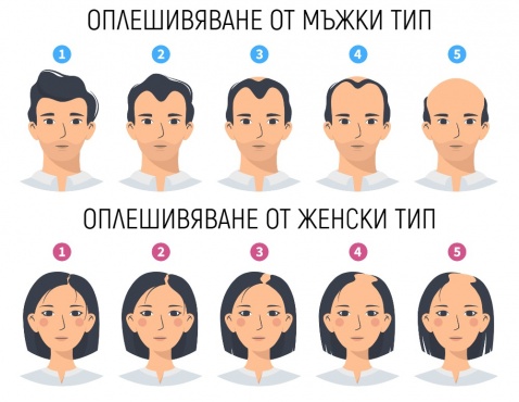 Мъжки и женски тип оплешивяване