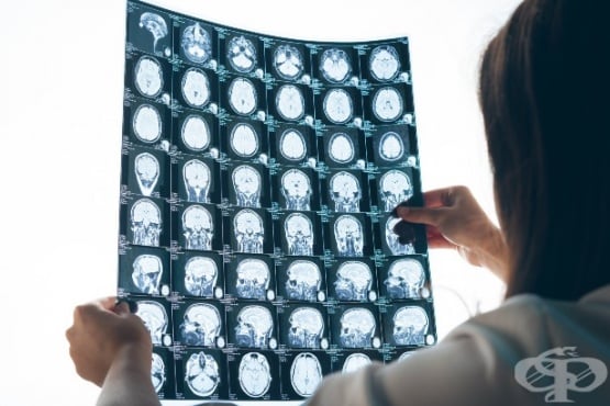 Образна диагностика при болест на Паркинсон