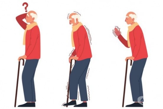 Основни симптоми при болест на Паркинсон: тремор, нестабилна походка, когнитивен спад