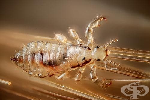 Главова въшка