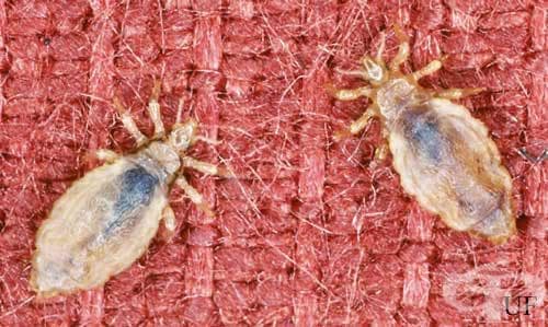 Дрешна въшка