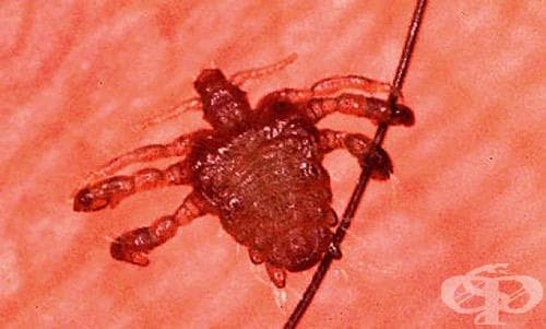 Срамна въшка