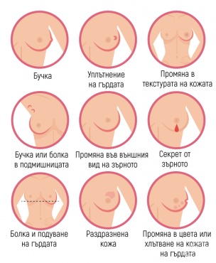 Симптоми на рак на гърдата