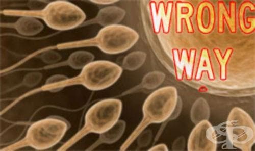 Ретроградна еякулация