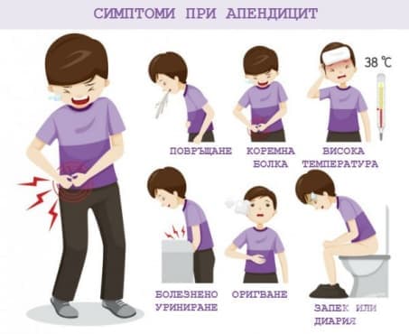 Симптоми при апендицит