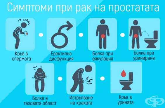 Симптоми при рак на простатата