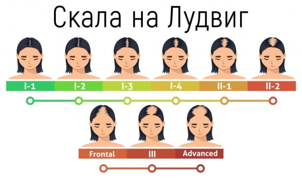 Скала на Лудвиг