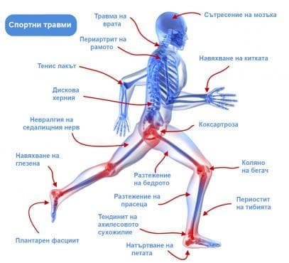 Чести спорни травми