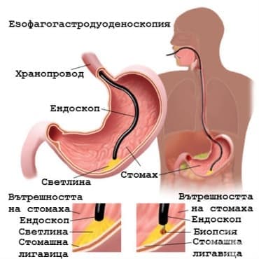 Езофагогастродуоденоскопия