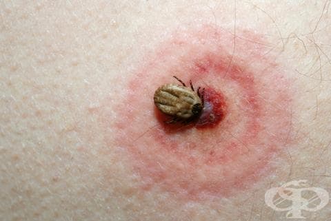 Ухапване от кърлеж