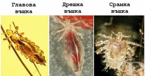 Видове въшки