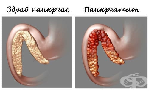 Здрав панкреас и панкреатит