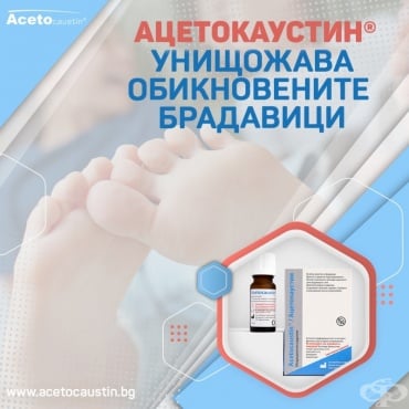 Унищожава обикновените брадавици