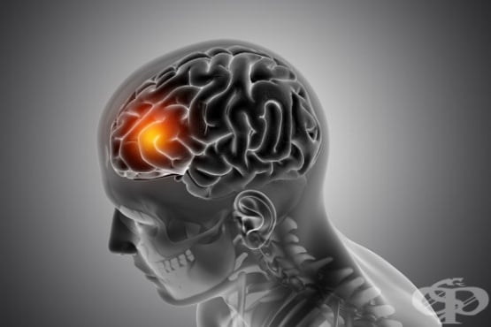 Интраоперативен SWIG метод позволява прецизна тотална резекция на мозъчни метастази и удължава преживяемостта при пациентите  - изображение