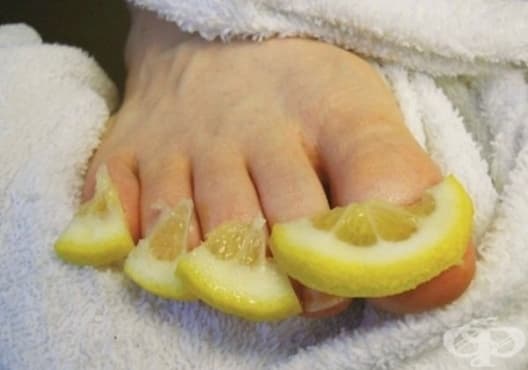 Правете компреси от сол и лимон срещу врастнал нокът - изображение