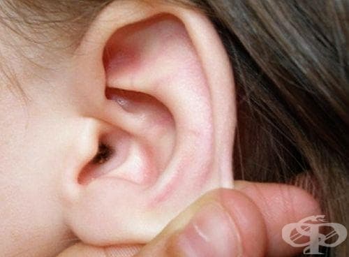 За какво е сигнал голямото количество ушна кал и как да я изчистим? - изображение