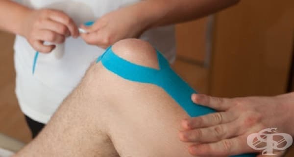 Бърза техника с кинезио лента за намаляване на болките в коляното  - изображение