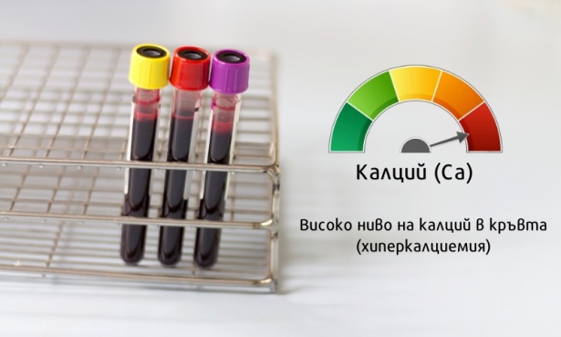 Високо ниво на калций в кръвта (хиперкалциемия) - изображение