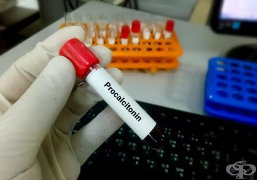 Изследване на прокалцитонин (PCT) - изображение