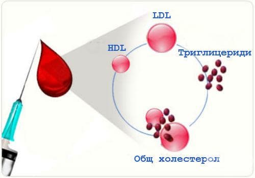 Изследване на триглицериди и холестерол - изображение