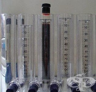 Изследване на утайка - изображение