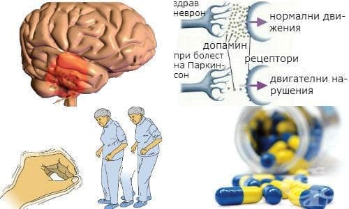 Антипаркинсонови лекарства - изображение