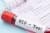 Изследване за HIV