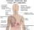 Симптоми при остра HIV инфекция