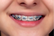 ��������� ����� �� ����� ������ �� ������ � ������� �� ������