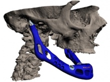       3D-  